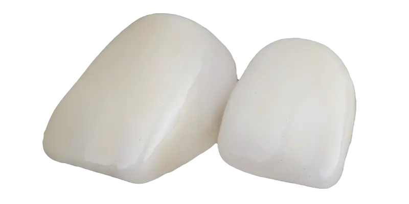 オールセラミック（e-max）