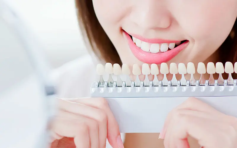 ホワイトニング