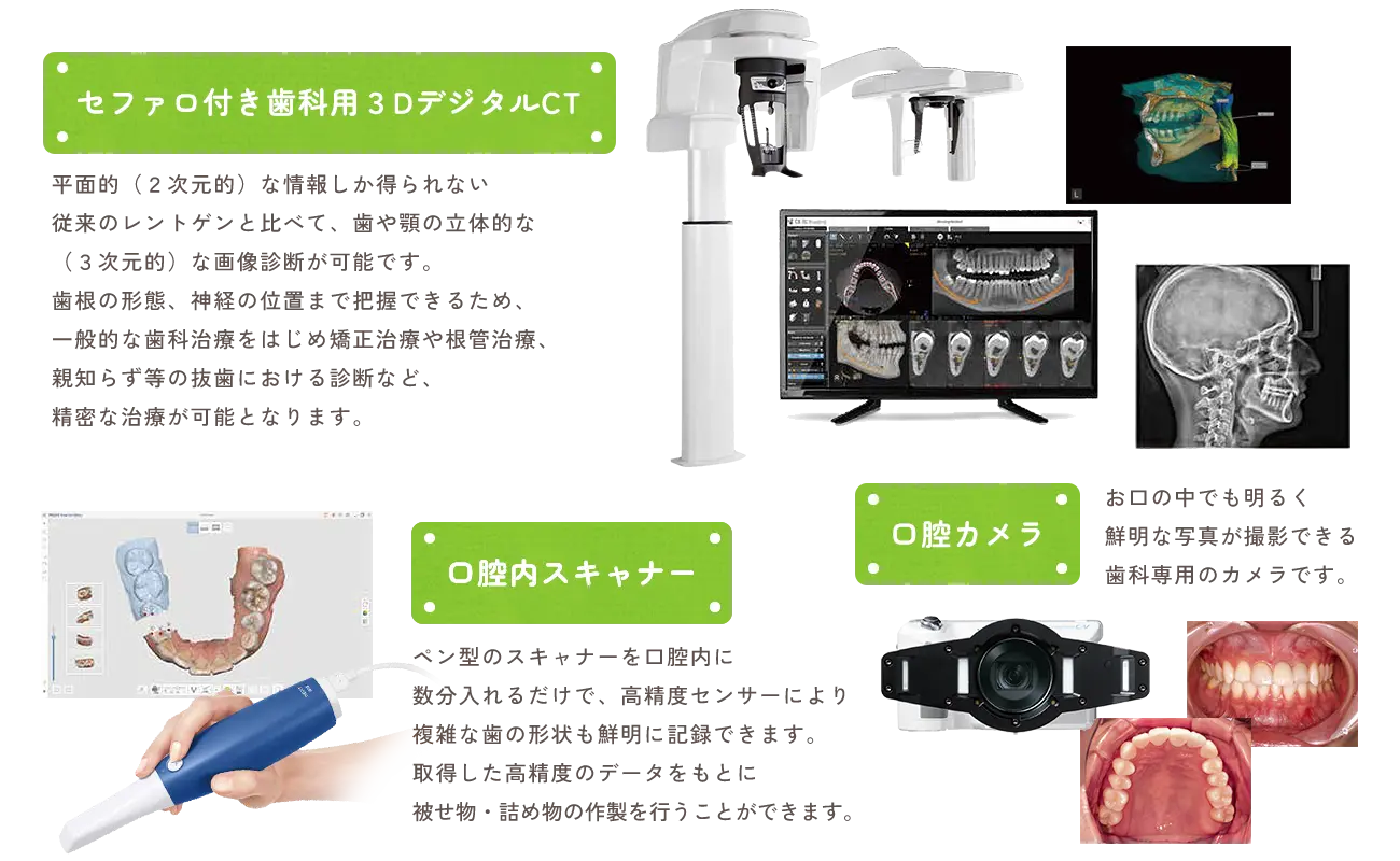 CT、口腔カメラ、口腔内カメラ