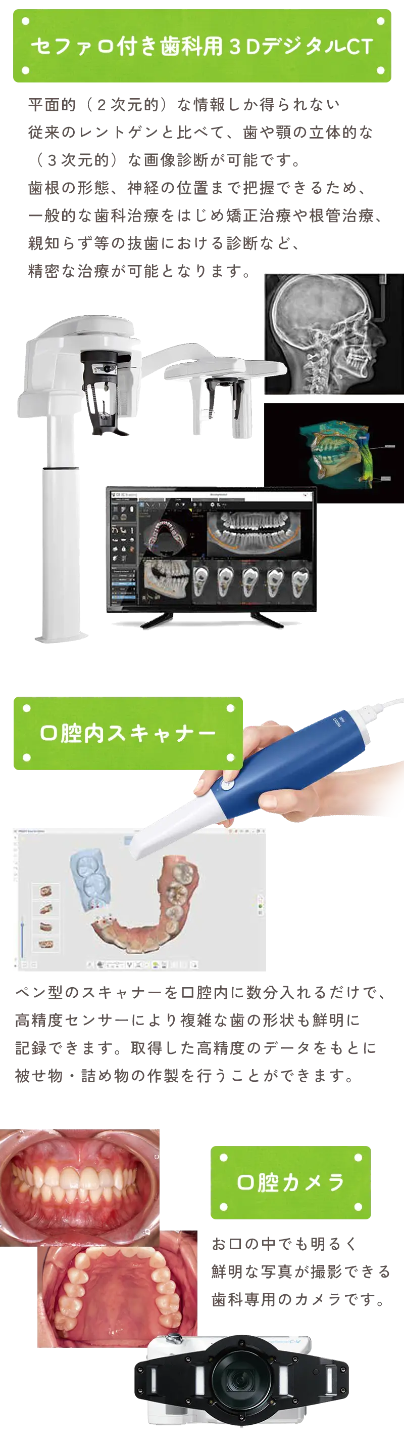 CT、口腔カメラ、口腔内カメラ