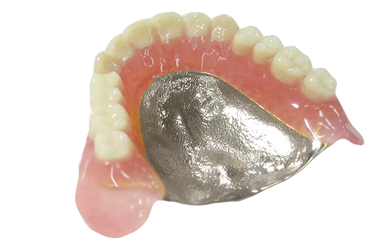 金属床義歯