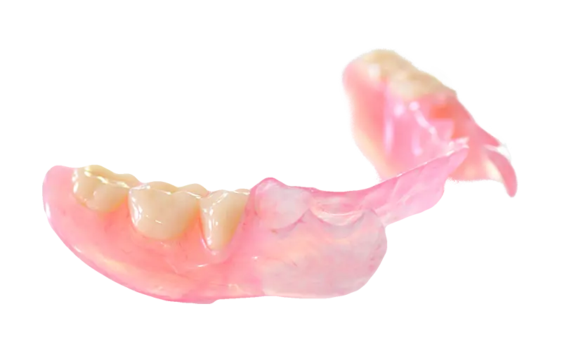 ノンメタルクラスプデンチャー