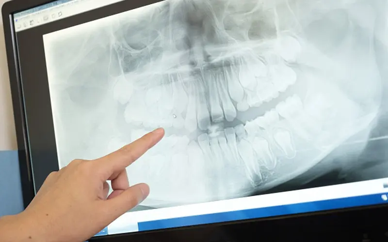 正しいお顔、姿勢、体
